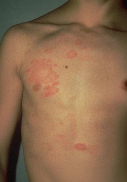 image comparison after