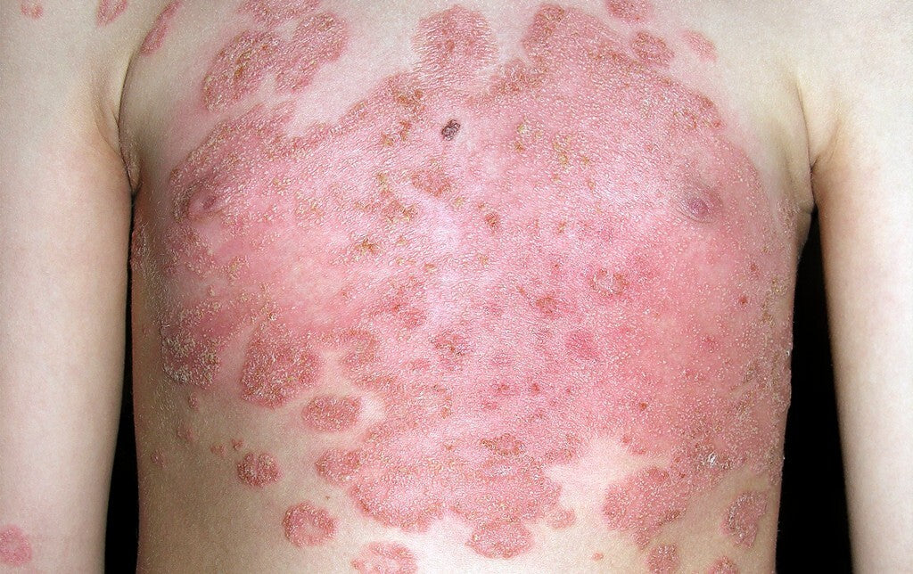 image comparison before