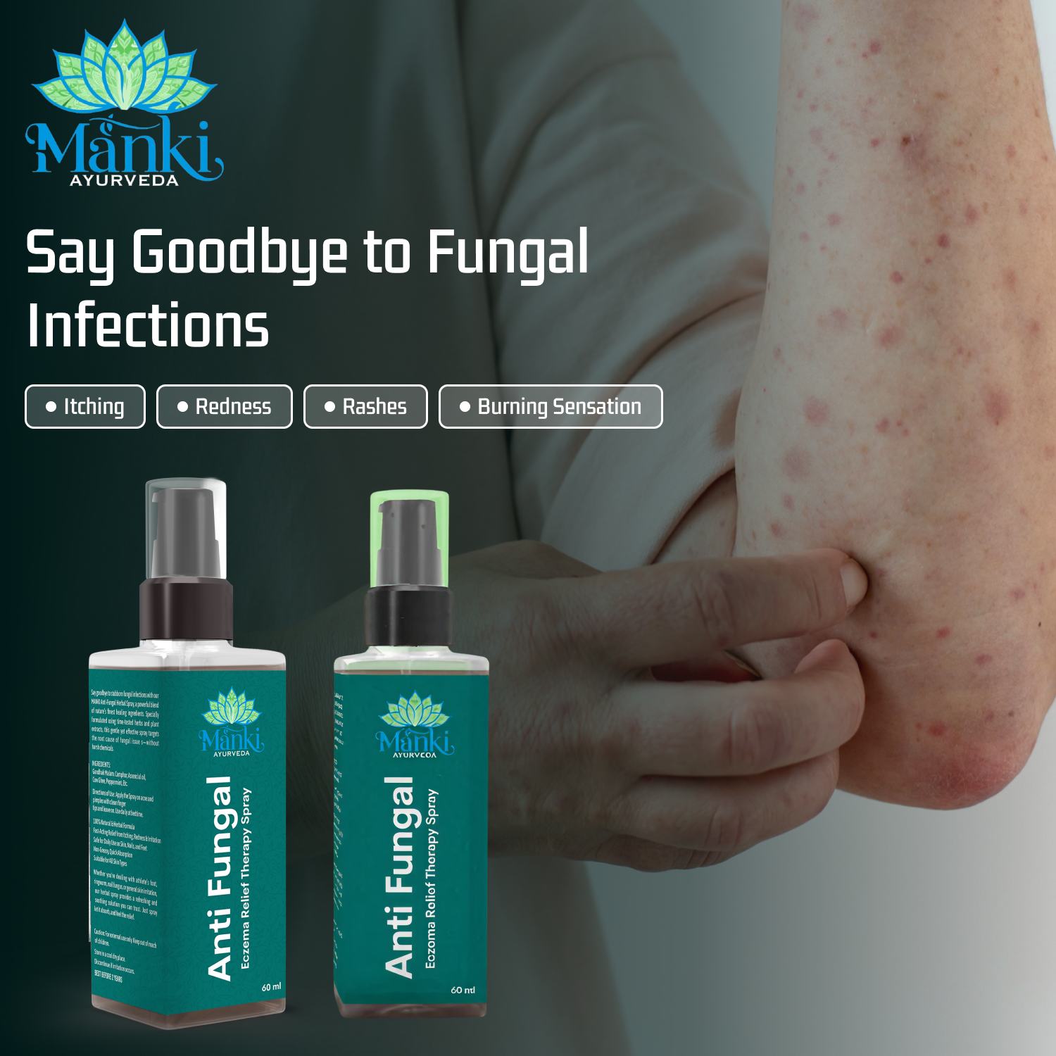 Manki Anti-Fungal Spray