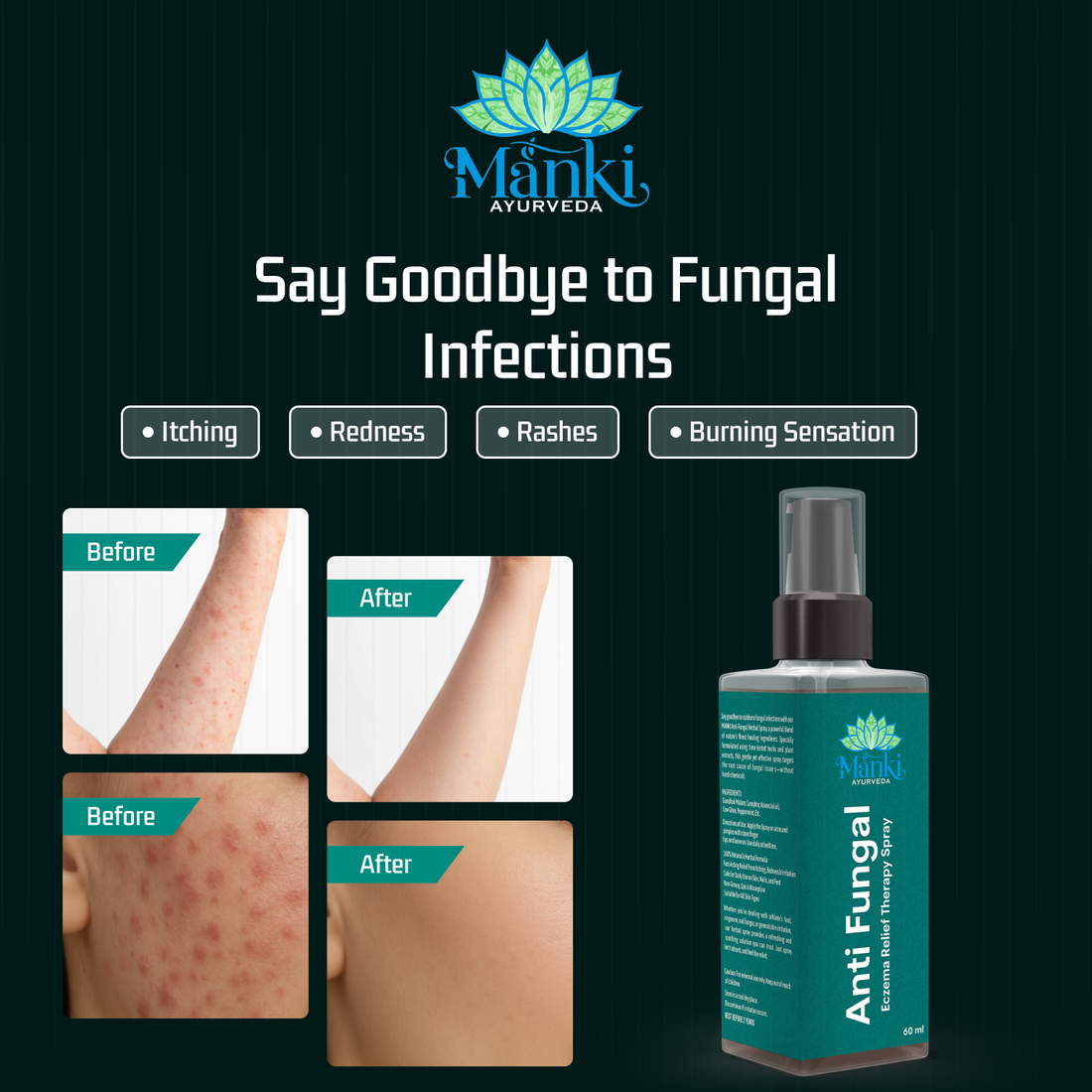Manki Anti-Fungal Spray