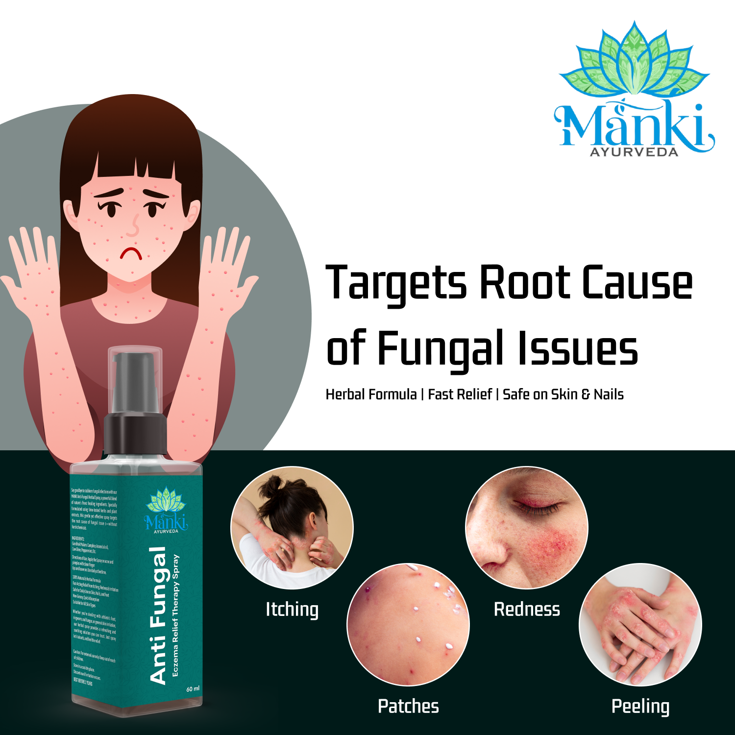 Manki Anti-Fungal Spray