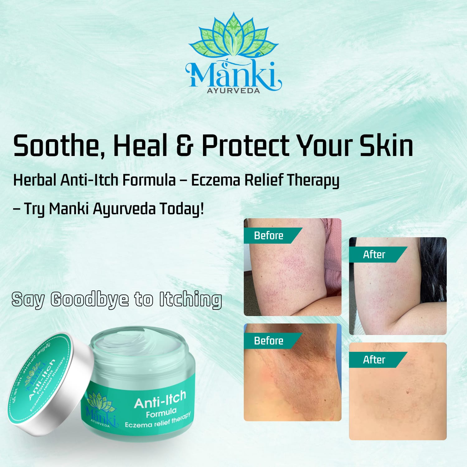 Manki Anti-Itch Formula Eczema Relief Therapy